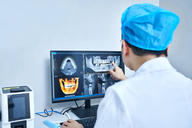 Best Emergency Wisdom Teeth Removal in High Springs, FL